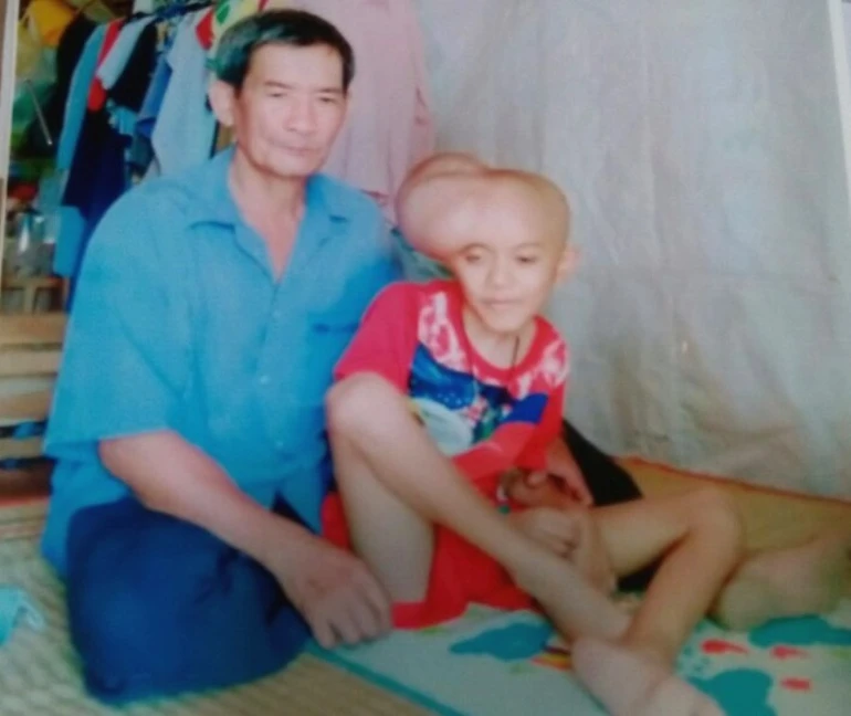 Giúp đỡ cháu bé bị ung thư não